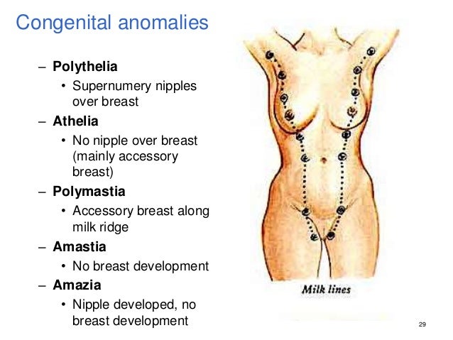 congenital anomalies of the breast Gay male feet fetish